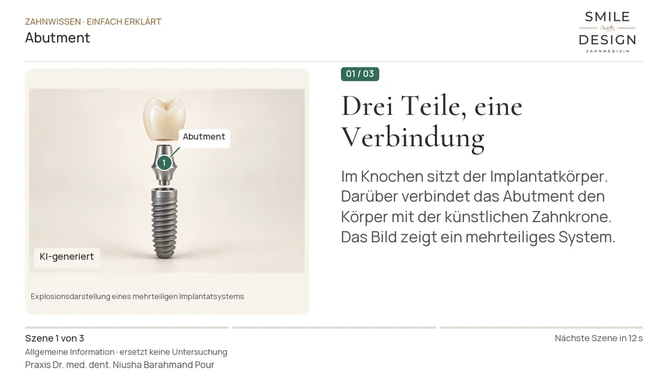 Kurzfilm: Was verbindet Implantat und Zahnkrone?