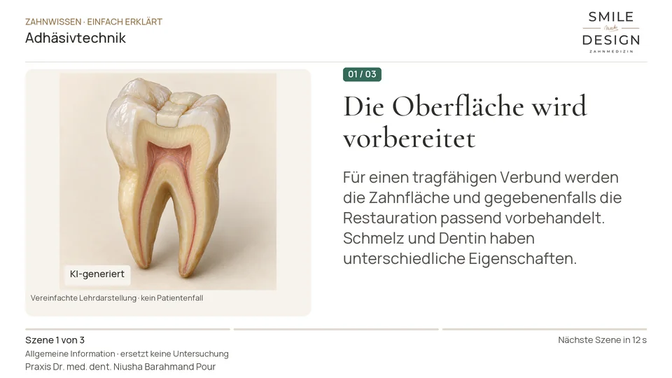 Kurzfilm: Wie wird eine Füllung mit dem Zahn verbunden?