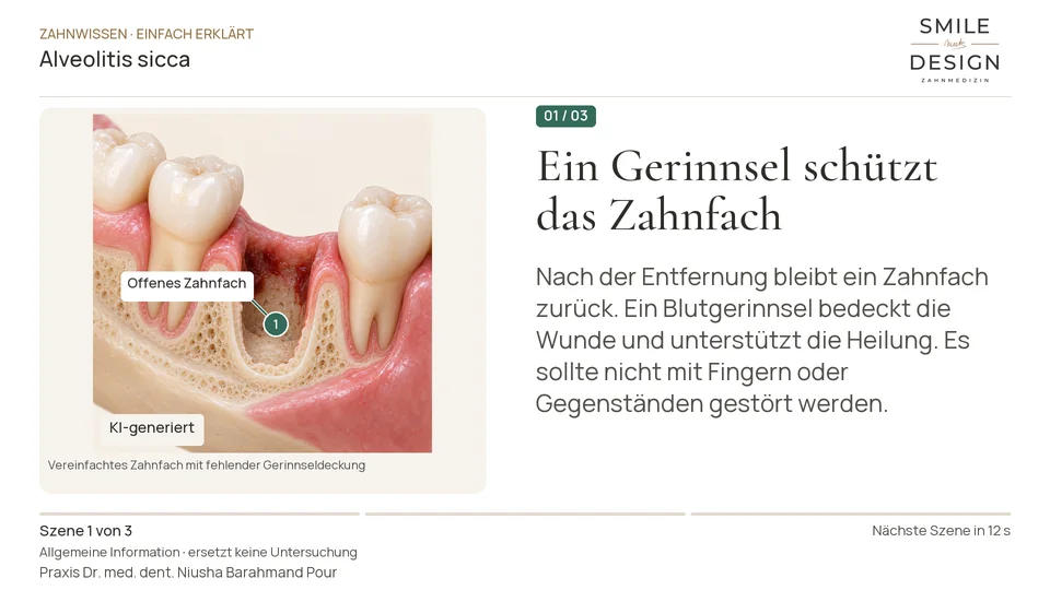 Kurzfilm: Warum können Schmerzen nach dem Zahnziehen zunehmen?