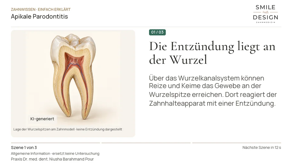 Kurzfilm: Was entzündet sich an der Wurzelspitze?