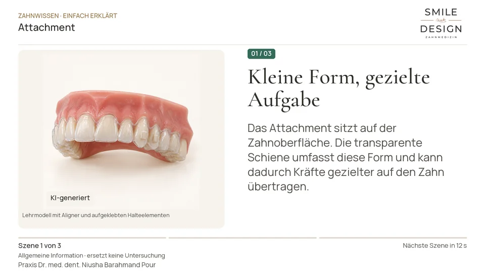 Kurzfilm: Wozu dienen die kleinen Aligner-Aufbauten?