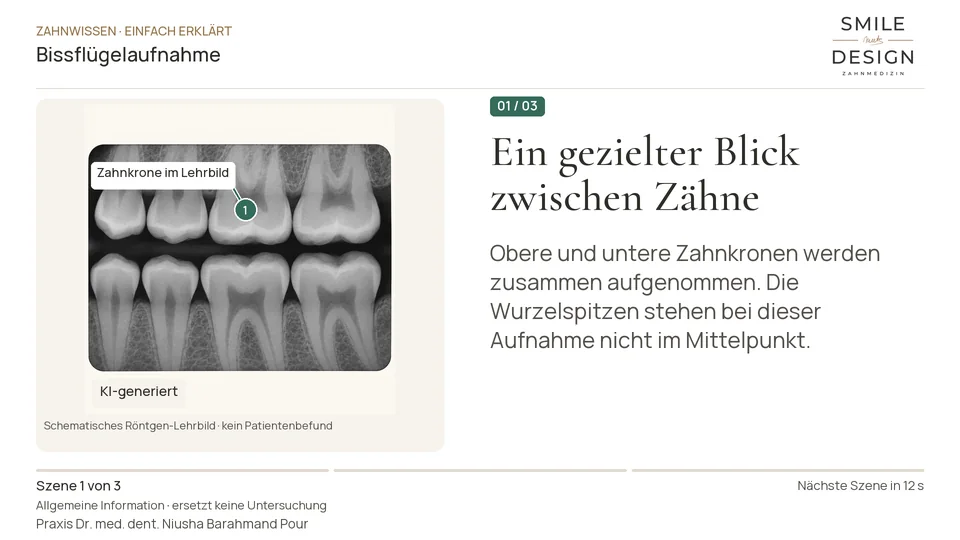 Short film (German): What does a bitewing X-ray show?