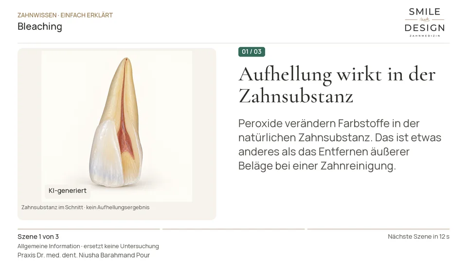Short film (German): How is the natural tooth colour lightened?