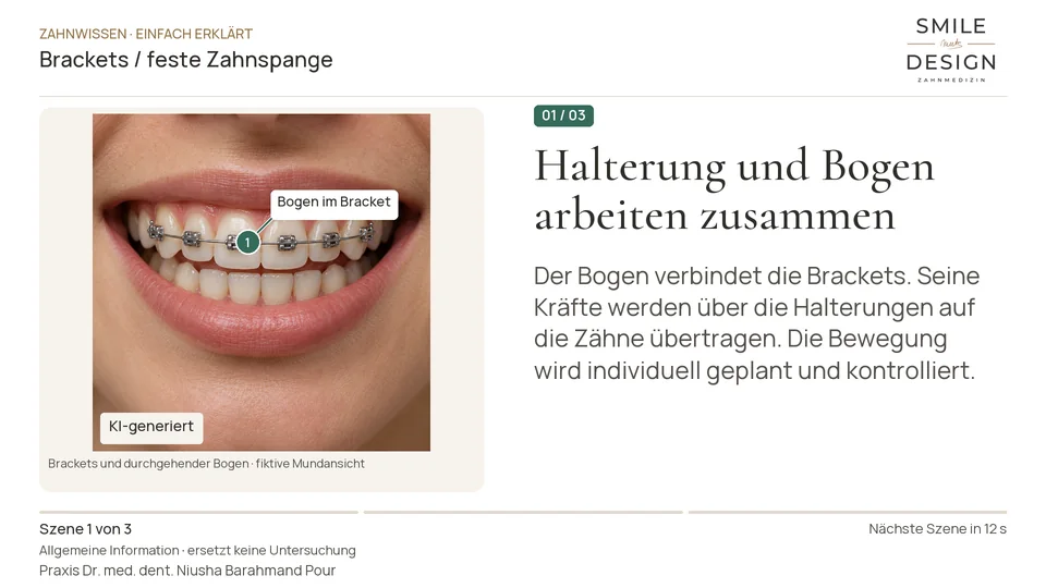 Short film (German): How do small attachments move teeth?
