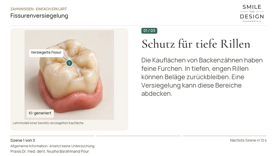 Kurzfilm: Was wird bei einer Fissurenversiegelung verschlossen?