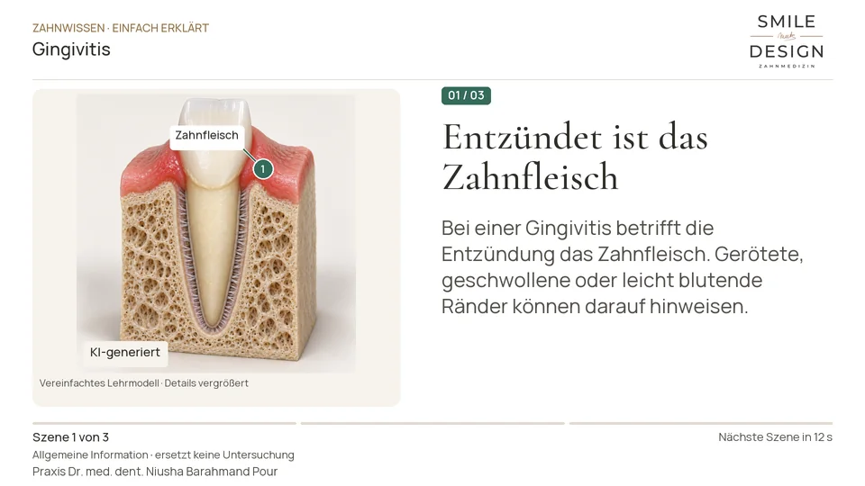 Kurzfilm: Was entzündet sich bei einer Gingivitis?