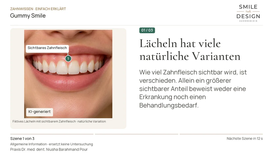Kurzfilm: Wenn beim Lächeln viel Zahnfleisch sichtbar ist