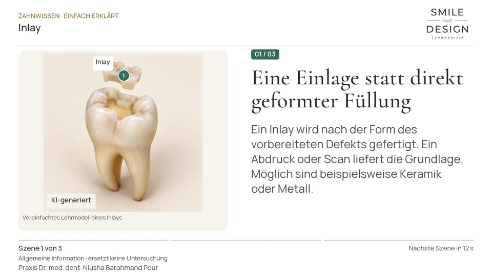 Kurzfilm: Wie unterscheidet sich ein Inlay?