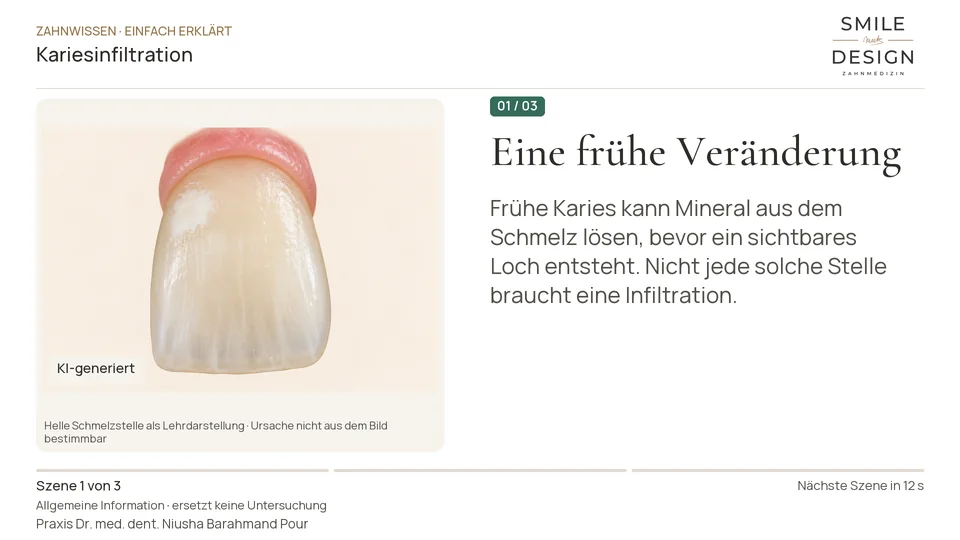 Kurzfilm: Wie lässt sich eine frühe Kariesstelle infiltrieren?