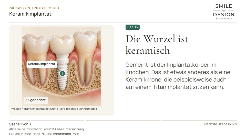 Kurzfilm: Was unterscheidet ein Keramikimplantat?