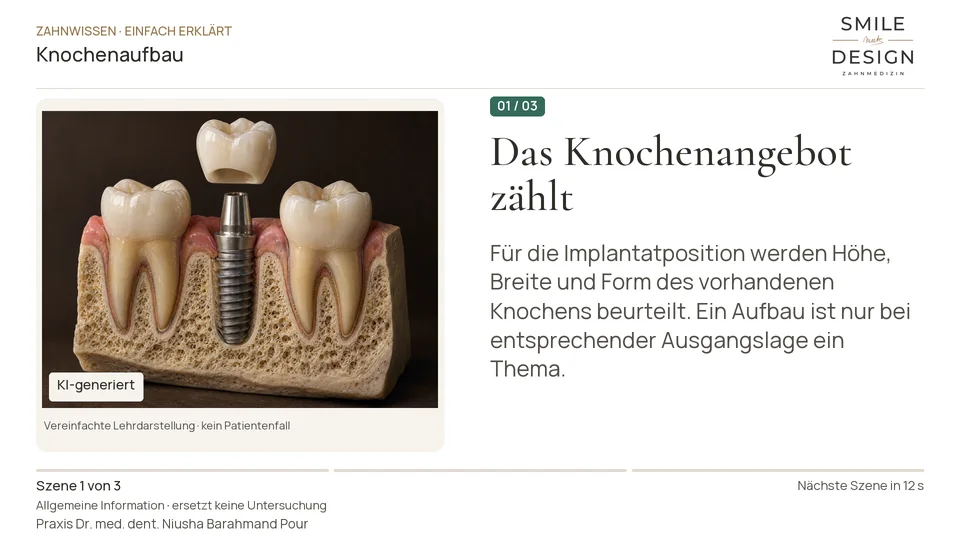 Kurzfilm: Wozu dient Knochenaufbau vor einem Implantat?