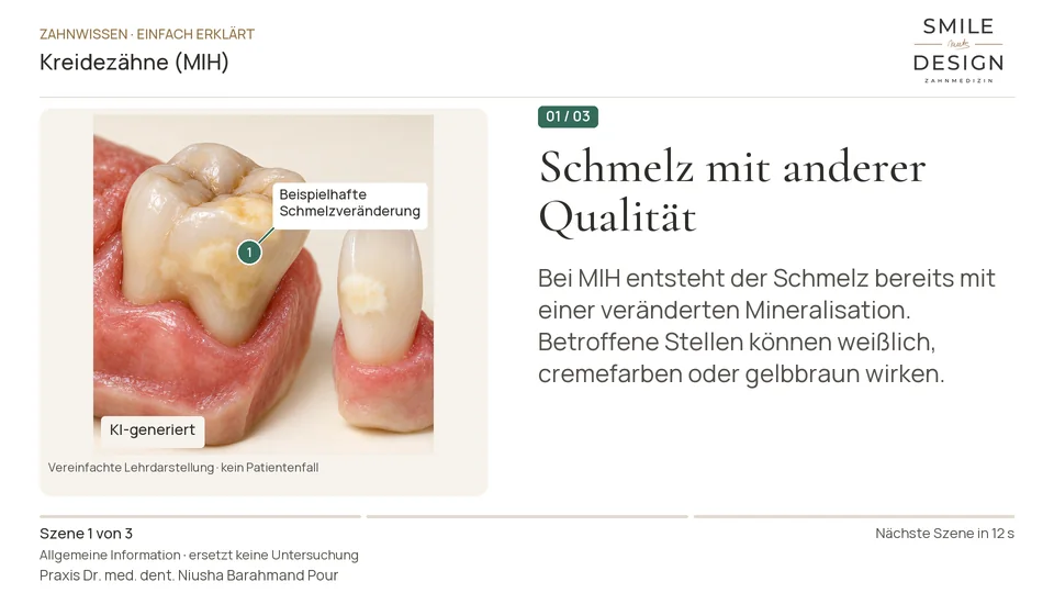 Short film (German): Why can newly erupted molars be fragile?