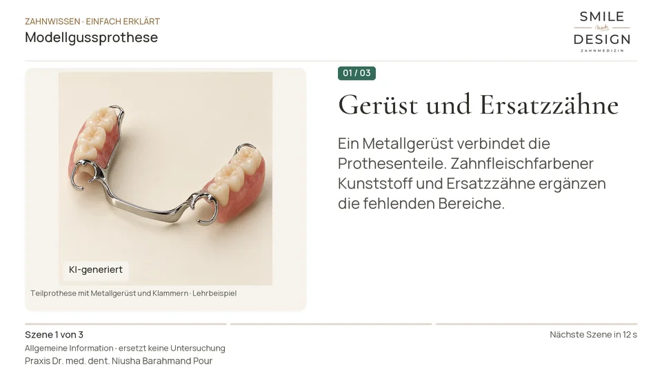 Kurzfilm: Wie hält eine Teilprothese mit Metallgerüst?