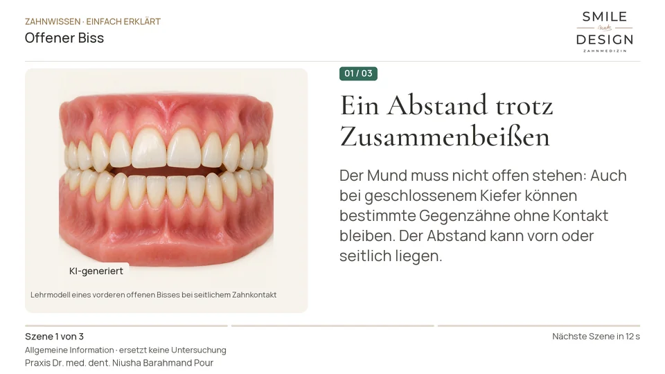Kurzfilm: Warum berühren sich manche Gegenzähne nicht?