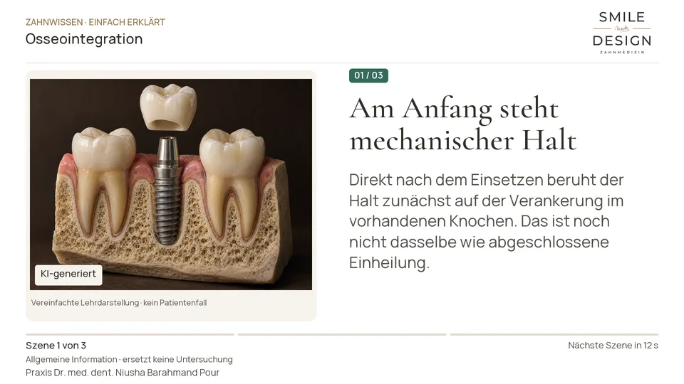 Short film (German): How does an implant join with bone?