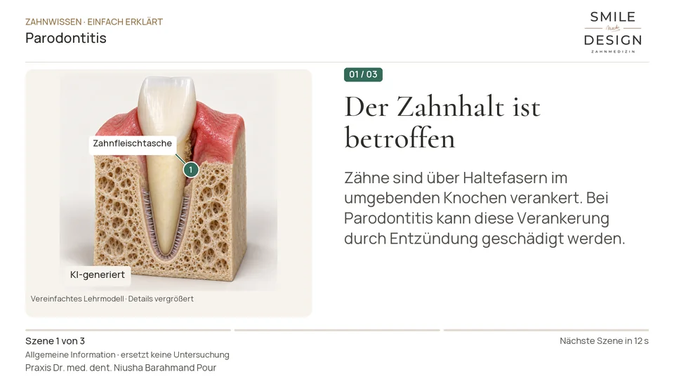 Short film (German): Why does periodontitis affect more than the gums?
