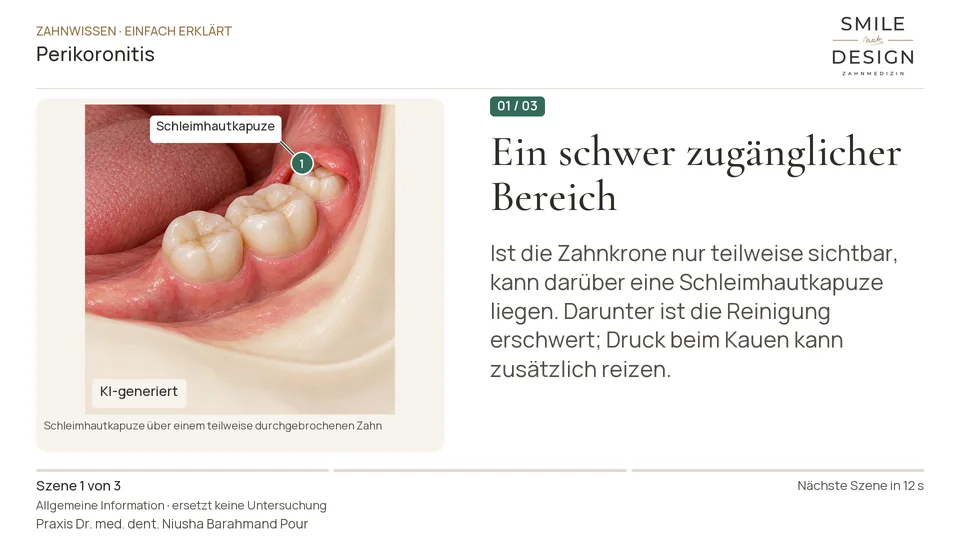 Kurzfilm: Warum entzündet sich das Zahnfleisch am Weisheitszahn?