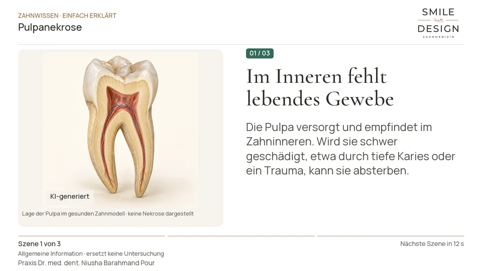 Kurzfilm: Was bedeutet ein „abgestorbener Zahnnerv“?
