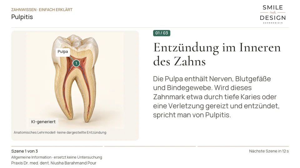 Short film (German): What becomes inflamed in pulpitis?