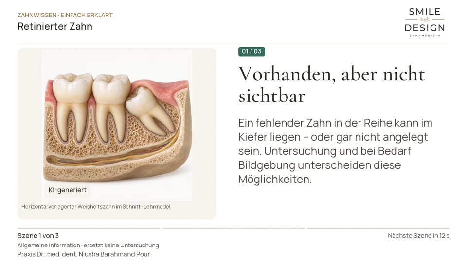 Kurzfilm: Warum bleibt ein Zahn im Kiefer?