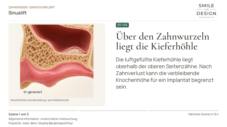 Kurzfilm: Was wird bei einem Sinuslift angehoben?