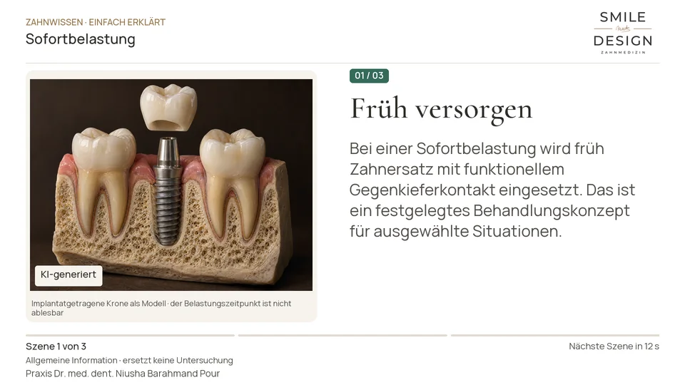 Kurzfilm: Kann ein Implantat direkt einen Zahn tragen?