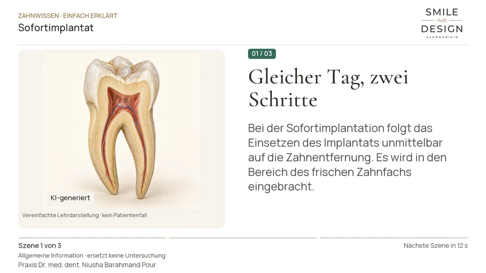 Kurzfilm: Heißt Sofortimplantat auch sofort feste Zähne?