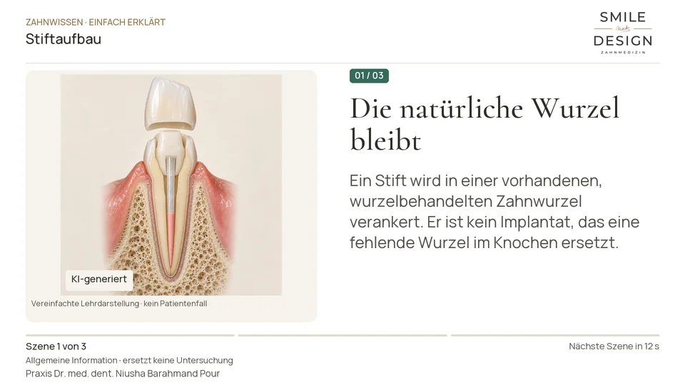 Kurzfilm: Wozu dient ein Stift in einem wurzelbehandelten Zahn?