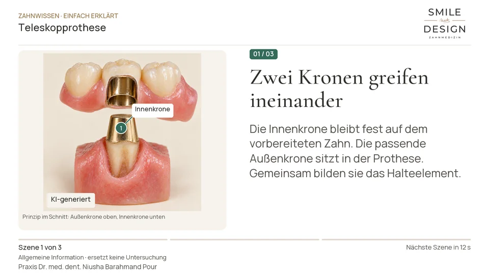 Short film (German): How does a telescopic denture stay in place?