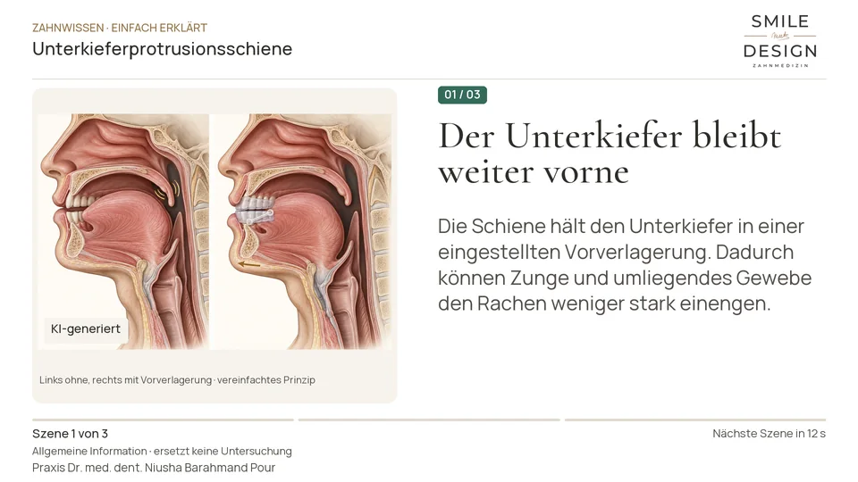 Kurzfilm: Wie hält eine Schiene den Atemweg offener?
