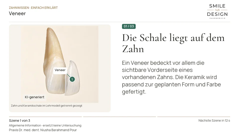 Kurzfilm: Was verändert eine Keramik-Verblendschale?