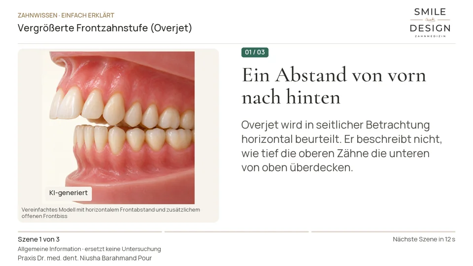 Kurzfilm: Was bedeutet der horizontale Abstand der Frontzähne?