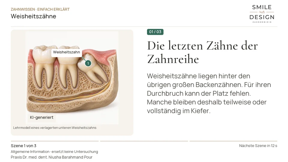 Short film (German): Do wisdom teeth always need to be removed?