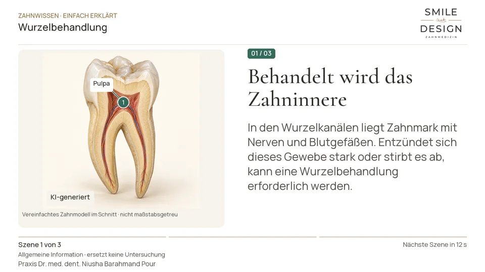 Kurzfilm: Bleibt die Zahnwurzel erhalten?