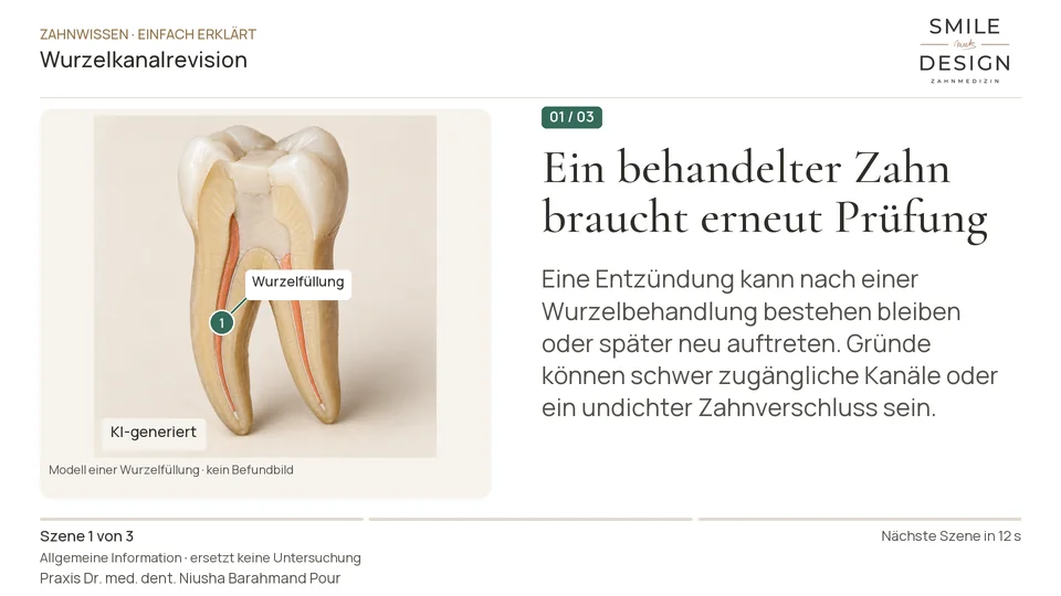 Kurzfilm: Warum wird eine Wurzelbehandlung wiederholt?