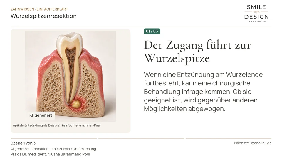 Kurzfilm: Was wird bei einer Wurzelspitzenresektion entfernt?