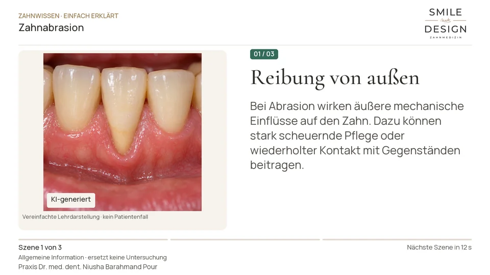Kurzfilm: Was bedeutet mechanischer Zahnabrieb?