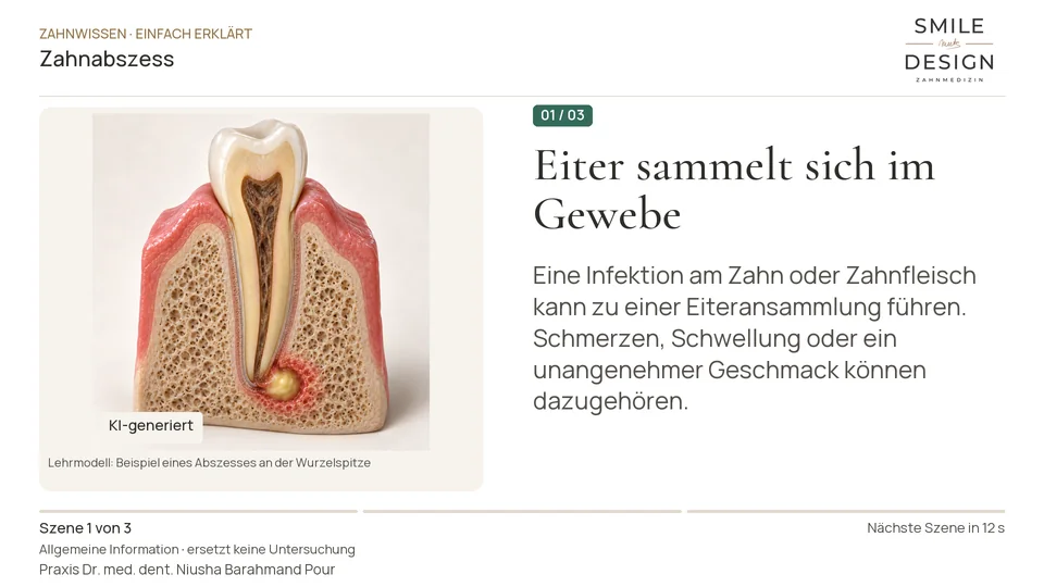 Kurzfilm: Was ist ein Abszess am Zahn?