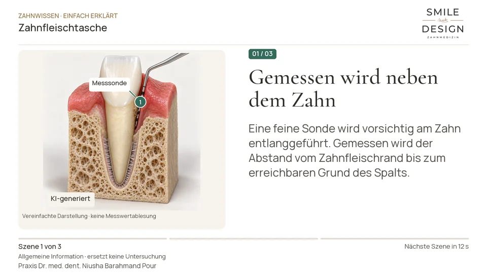 Short film (German): What does the probe measure at the gums?