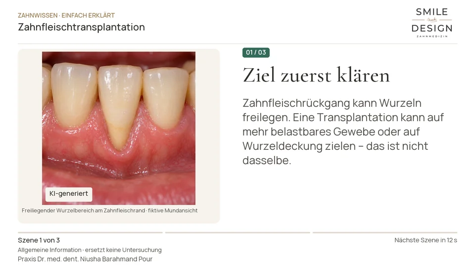 Short film (German): Why is gum tissue transplanted?