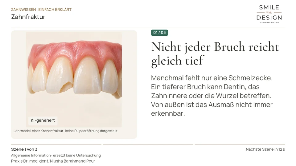 Kurzfilm: Was bedeutet ein abgebrochener Zahn?