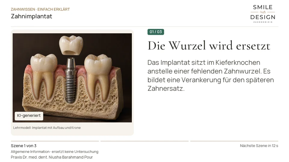 Kurzfilm: Welcher Teil des neuen Zahns ist das Implantat?