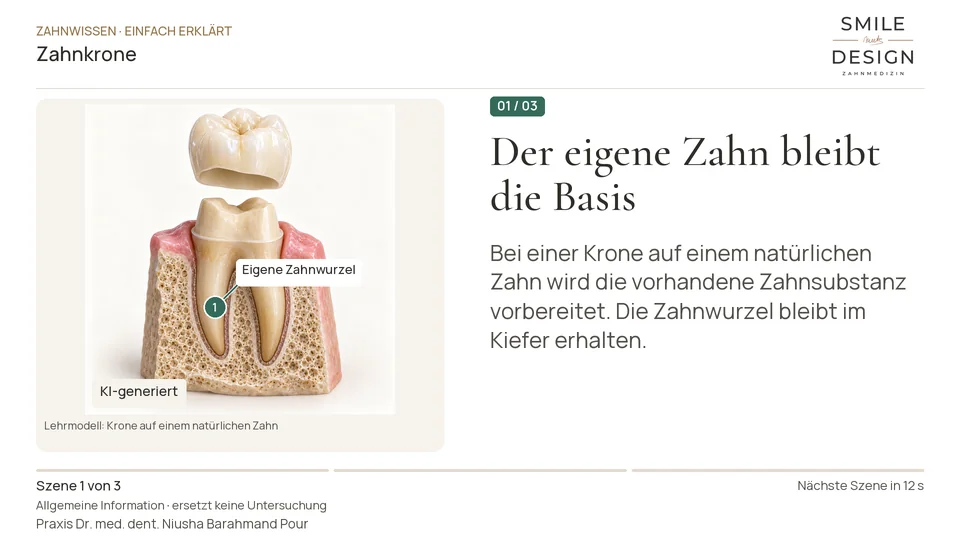 Short film (German): Does your own tooth remain beneath a crown?