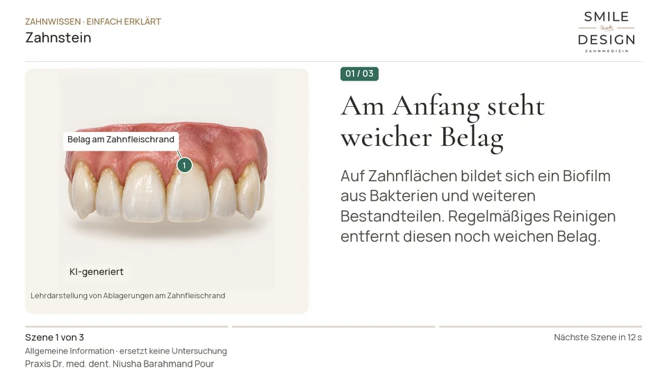 Kurzfilm: Warum wird weicher Zahnbelag hart?