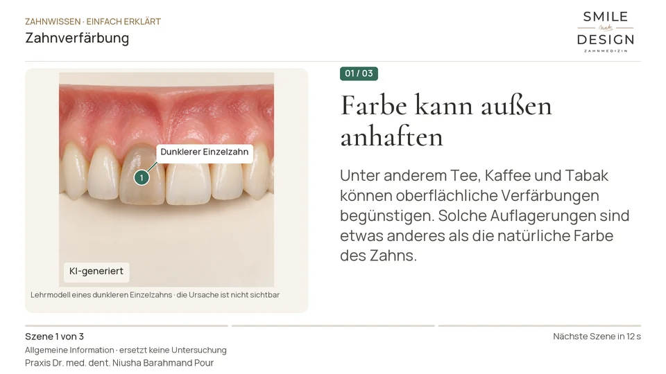 Kurzfilm: Sitzt die Farbe auf dem Zahn oder im Zahn?